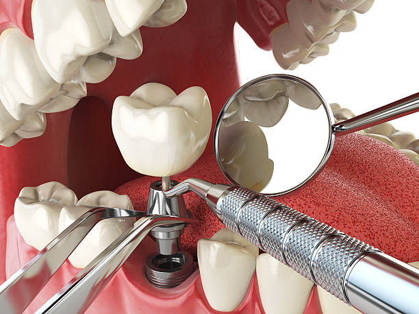 Best Mobile Emergency Dentist in Rustburg, VA