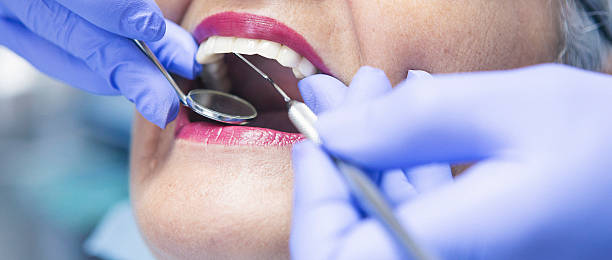 Best Broken or Cracked Tooth Emergency Dentist in Rustburg, VA